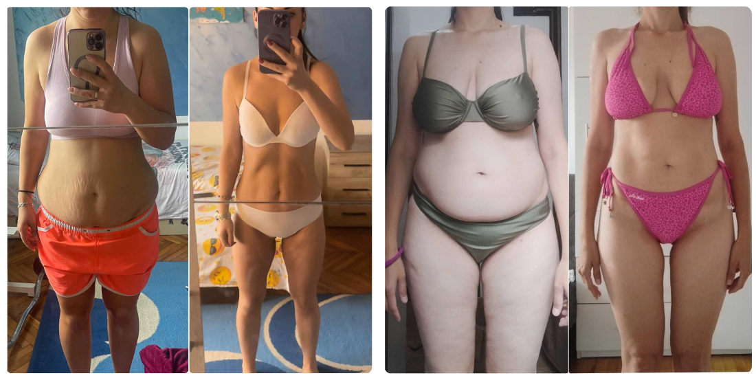 dijastaza online nikola orozovic